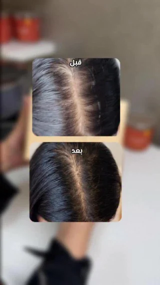 Instagram post from collagen.uae. This post is in position 4.