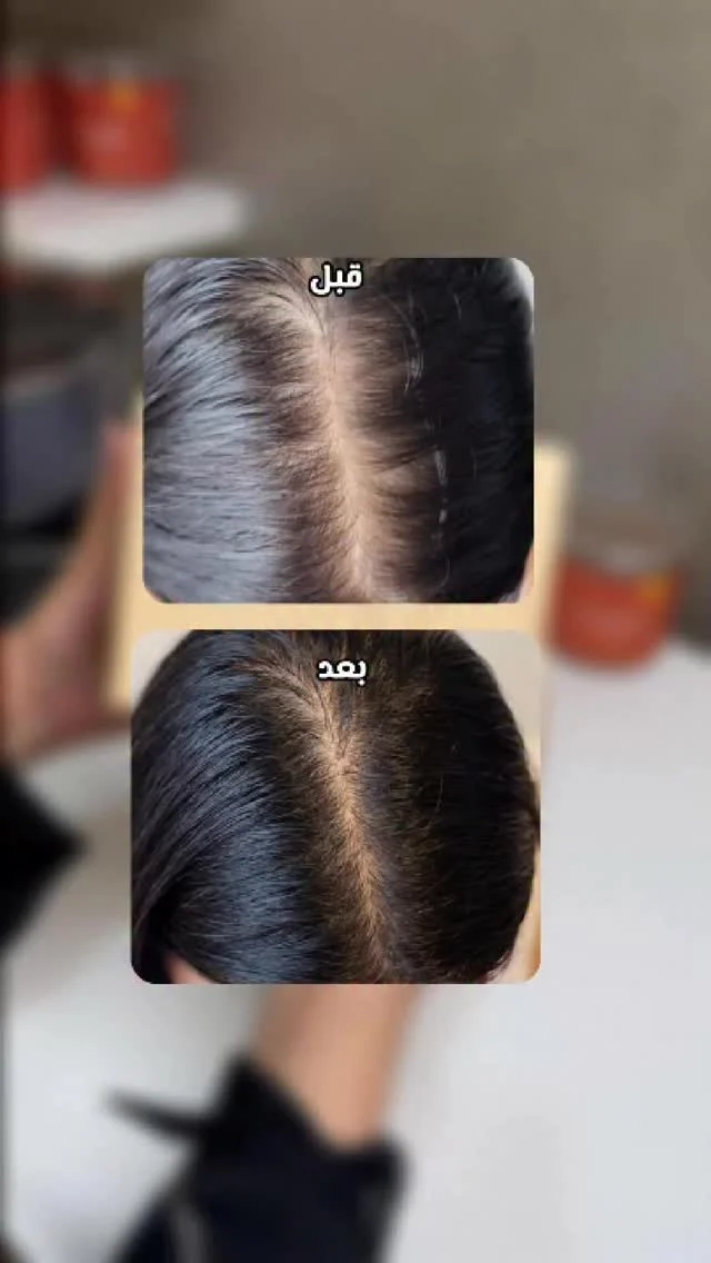 Instagram post from collagen.uae. This post is in position 3.